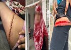 जबलपुर में युवतियों ने एक-दूसरे पर चलाए चाकू