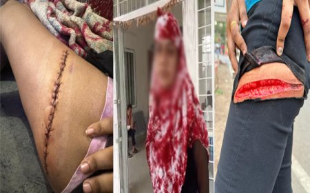 जबलपुर में युवतियों ने एक-दूसरे पर चलाए चाकू