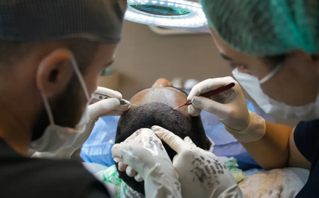 लुक को बेहतर बनाने हेयर ट्रांसप्लांट का बढ़ा चलन, विदेशों में जाकर करवा रहे ट्रीटमेंट