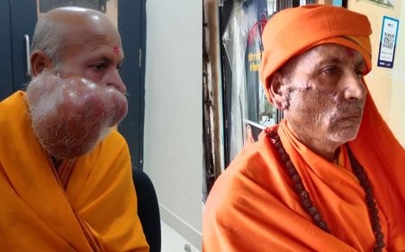 बड़ेरिया मेट्रोप्राइम हॉस्पिटल में चेहरे के 3 किलो के ट्यूमर का हुआ सफल ऑपरेशन