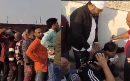 सिर्फ 20 रुपए में बाल उगाने की मिल रही दवा, लोगों की भीड़ उमड़ी