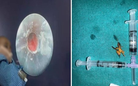 देवदूत बनकर डॉक्टरों ने बचाई दो मासूमों की जान...