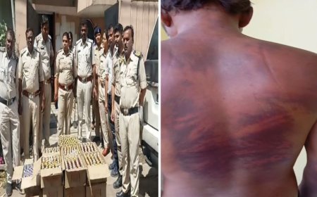 युवक के बदन पर पुलिस की बर्बरता के निशान