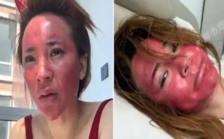 स्किन प्रॉब्लम- महिला ने 22 साल तक नहीं उतारा मेकअप, हाल देख हर कोई हैरान